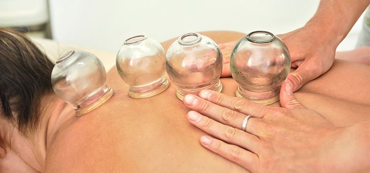 Cupping therapy institute | Adiyogi cup clinic